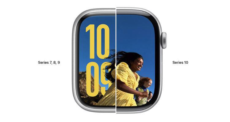 Apple Watch Series 10