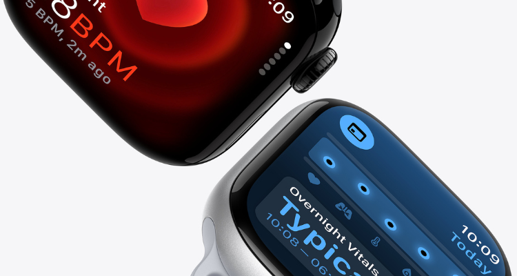 Apple Watch Series 10